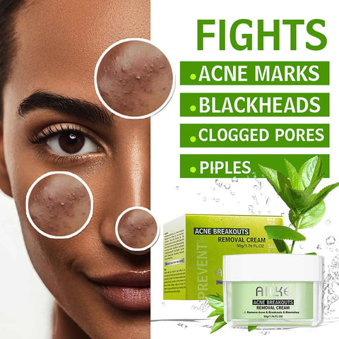 Catch A Break Natural Acne Treatment Face cream,