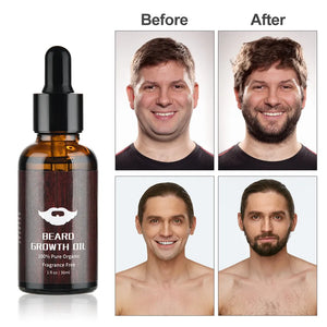 Catch A Break Beard Growth Kit